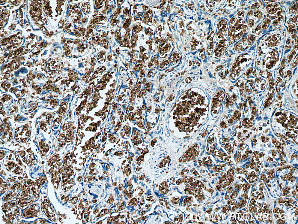 IHC staining of human placenta using 67714-1-Ig