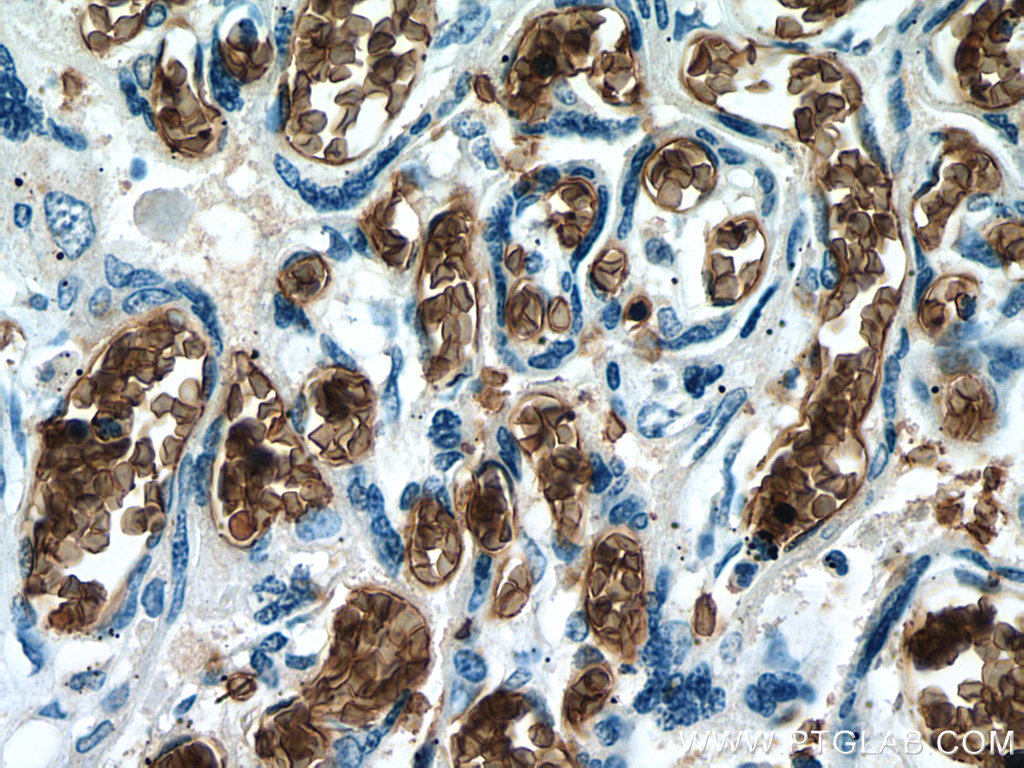 IHC staining of human placenta using 67714-1-Ig