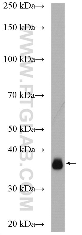 WB analysis of mouse kidney using 20869-1-AP