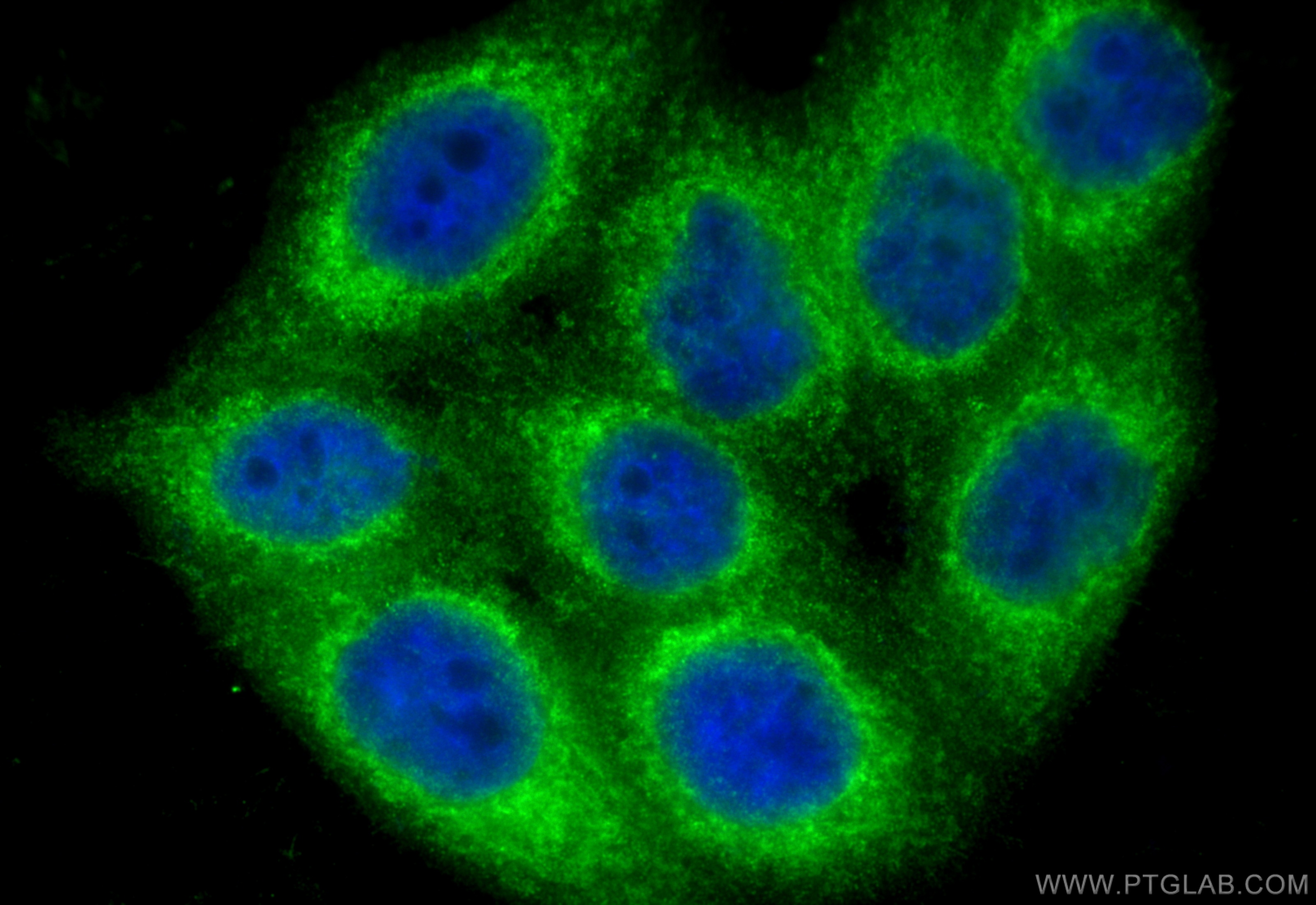 IF Staining of HepG2 using 23181-1-AP