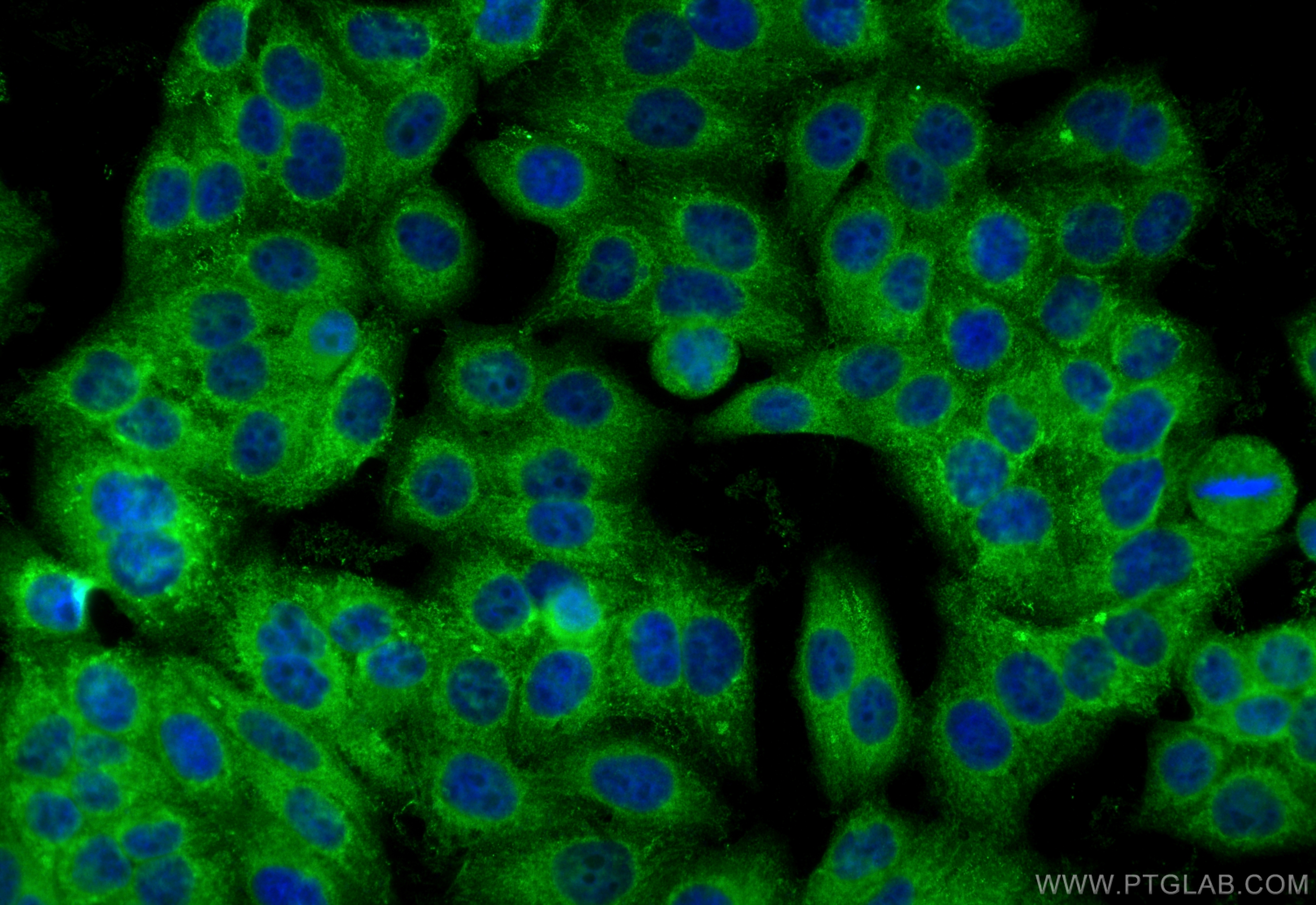 IF Staining of HepG2 using 23181-1-AP