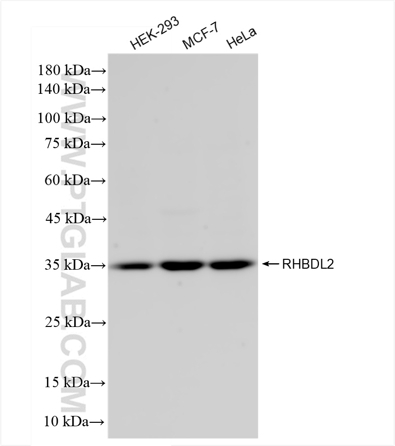 WB analysis using 84589-1-RR (same clone as 84589-1-PBS)