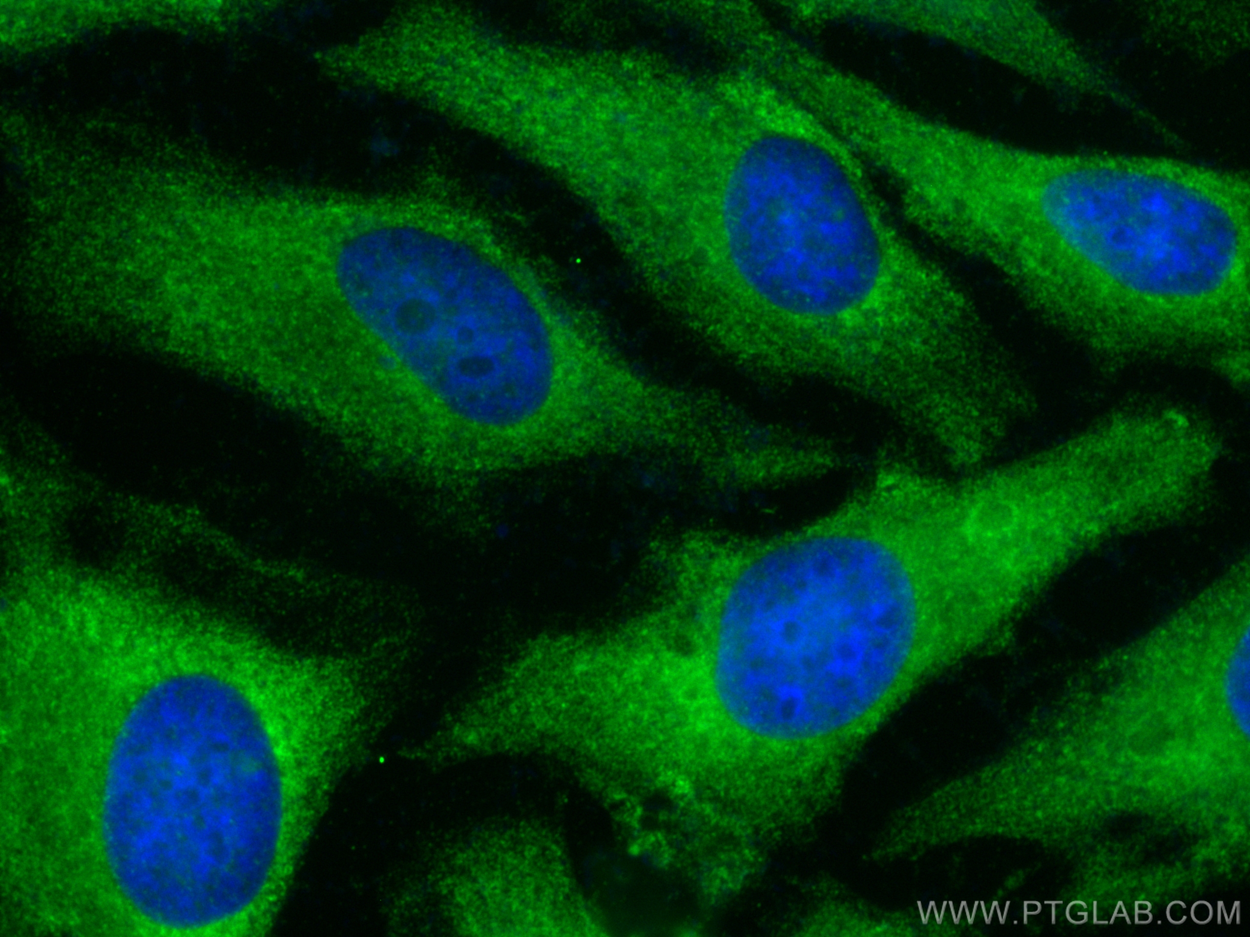 IF Staining of HeLa using 10749-1-AP