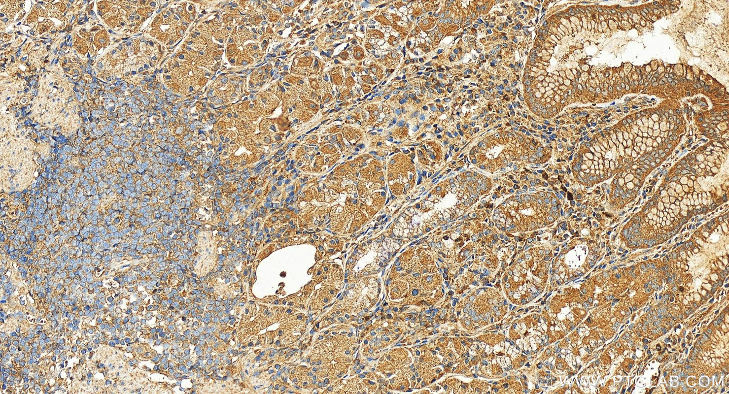 IHC staining of human stomach using 27213-1-AP