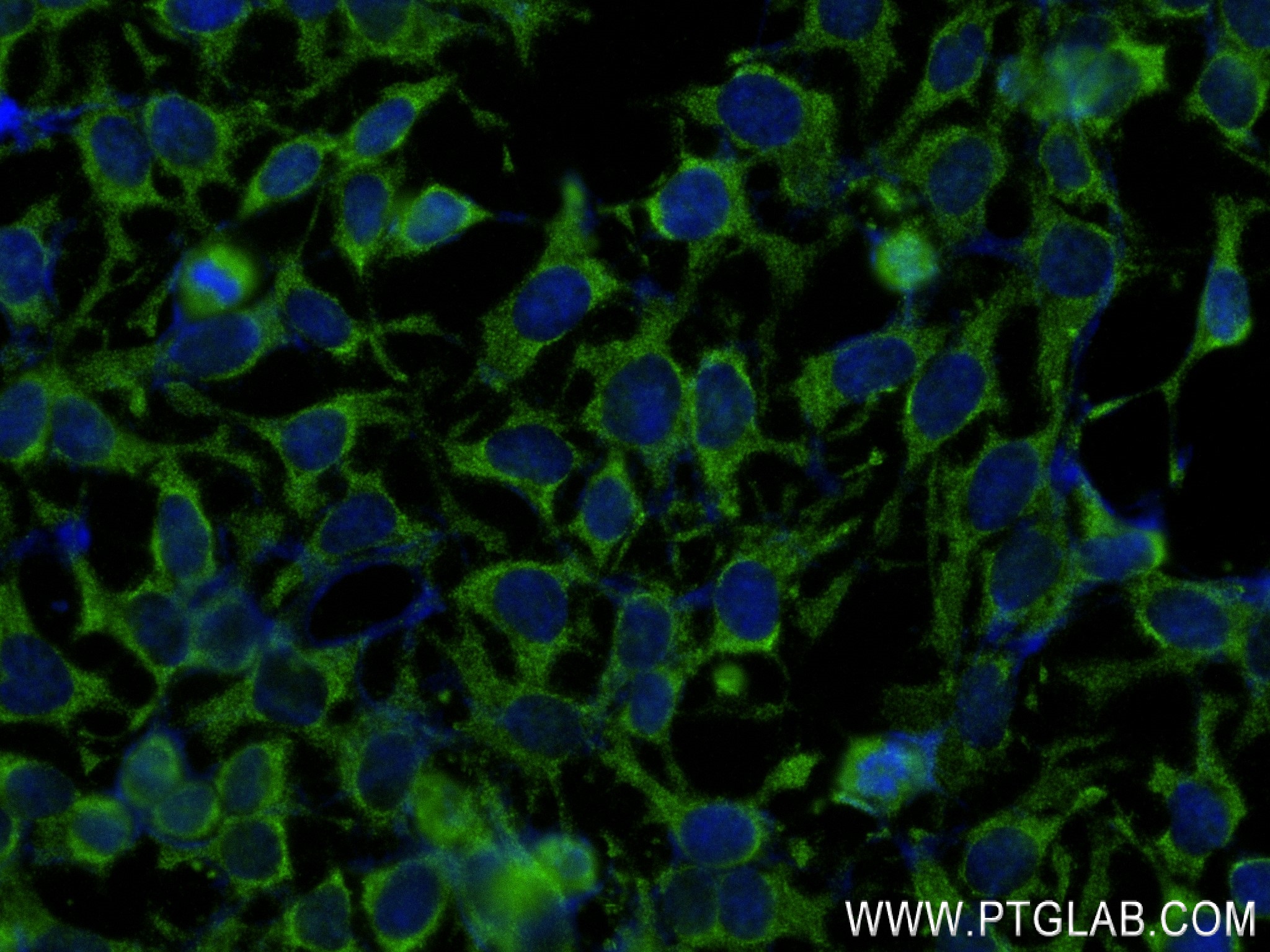 IF Staining of HeLa using 82760-2-RR