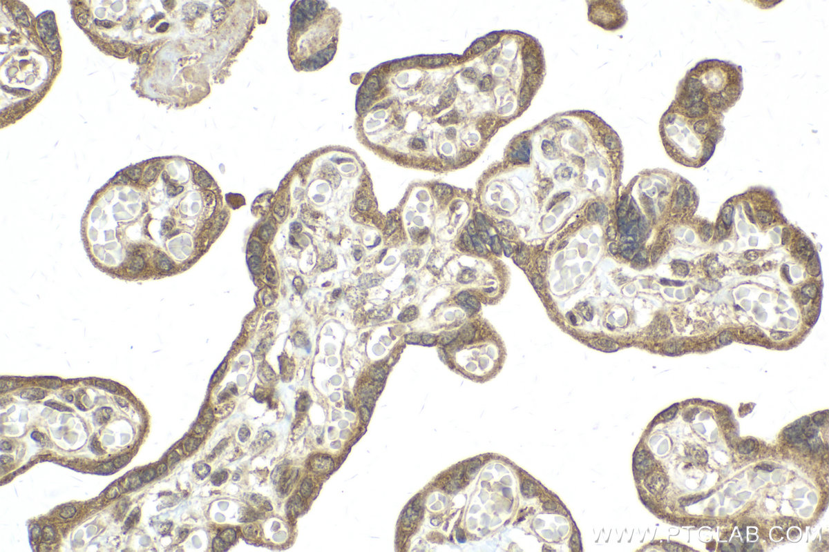 IHC staining of human placenta using 13945-1-AP