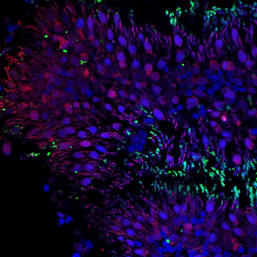 IF Staining of Human Retina Whole Mount using 11717-1-AP