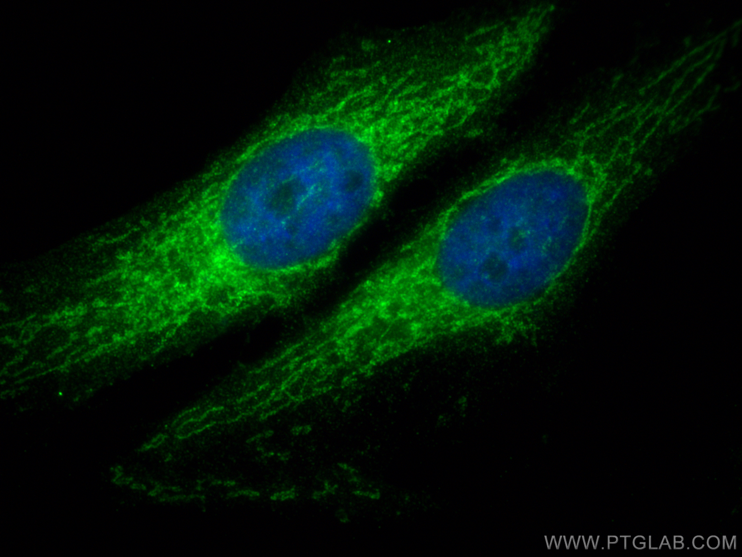 IF Staining of HeLa using 11237-1-AP