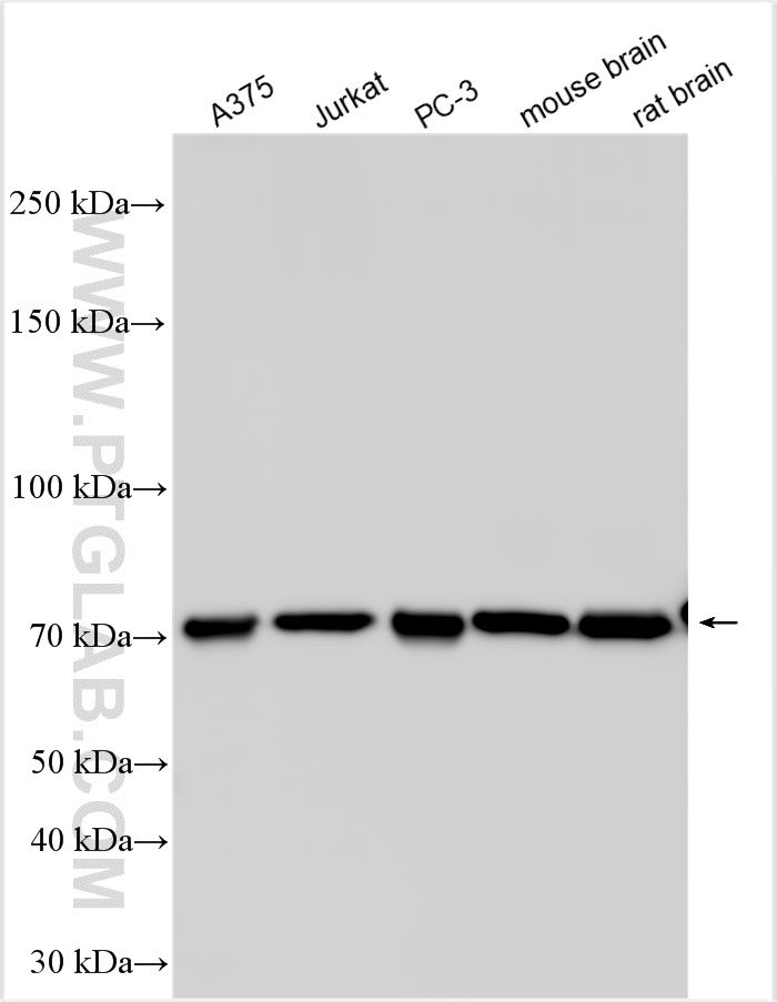 WB analysis using 13460-1-AP