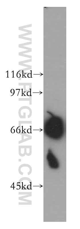 RHPN1