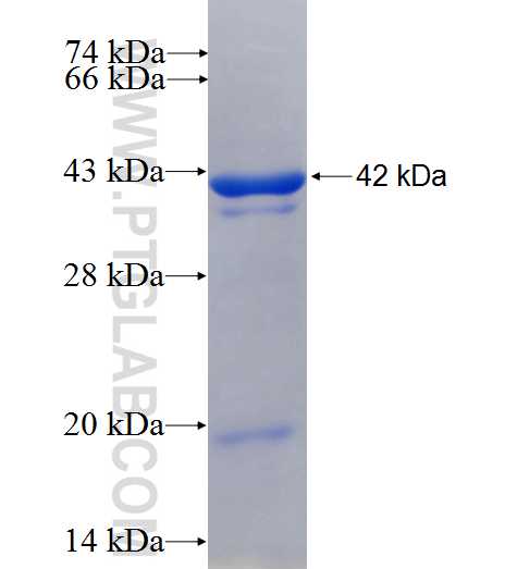 RHPN1 fusion protein Ag25205 SDS-PAGE