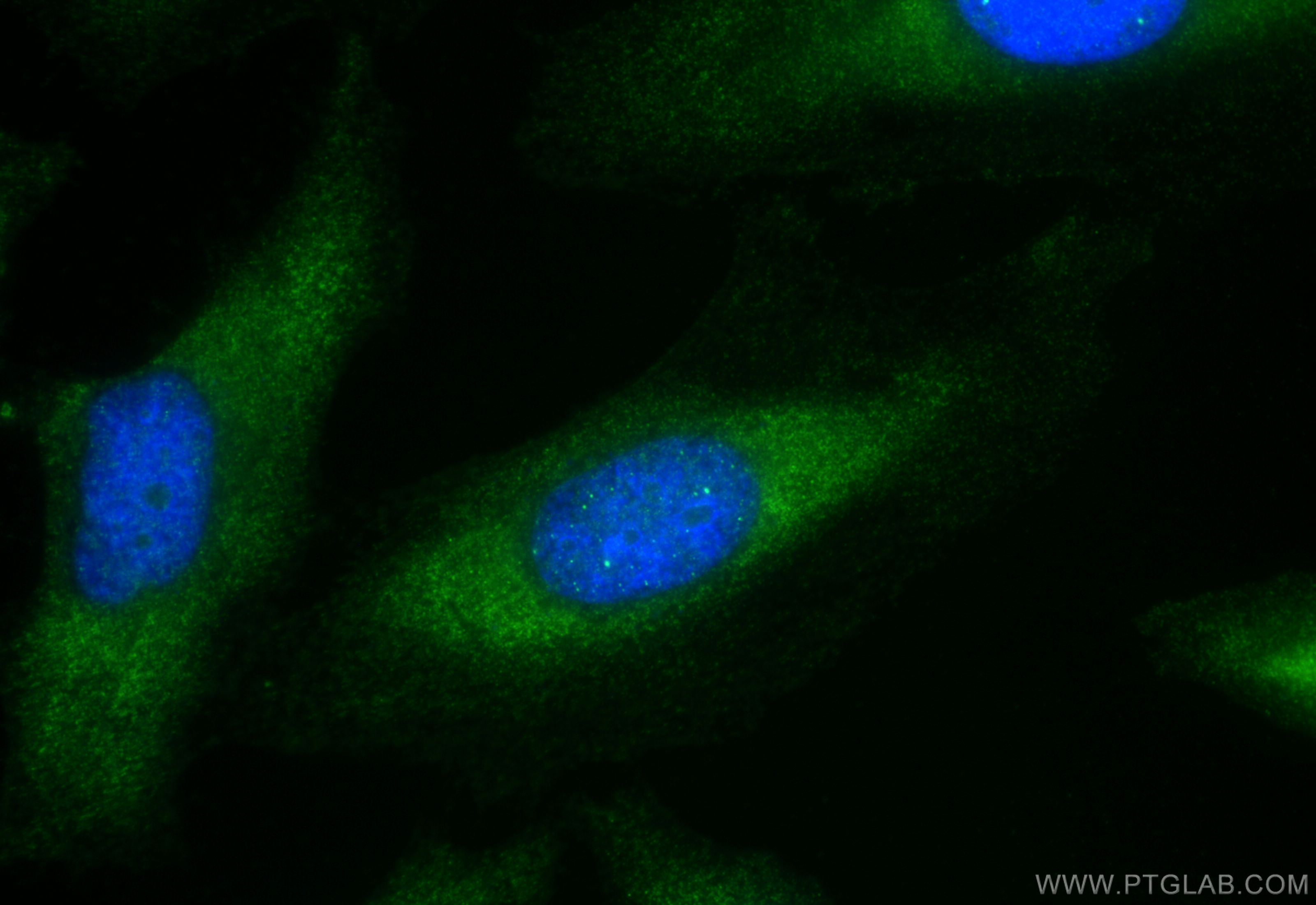 IF Staining of HeLa using 18707-1-AP