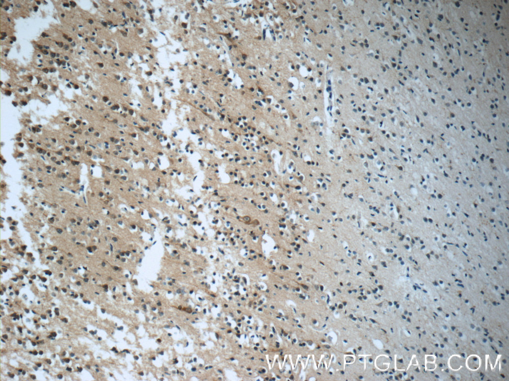 IHC staining of human brain using 18707-1-AP