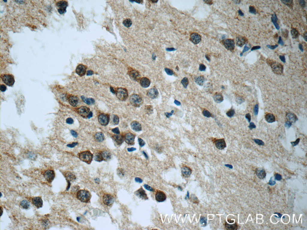 IHC staining of human brain using 18707-1-AP