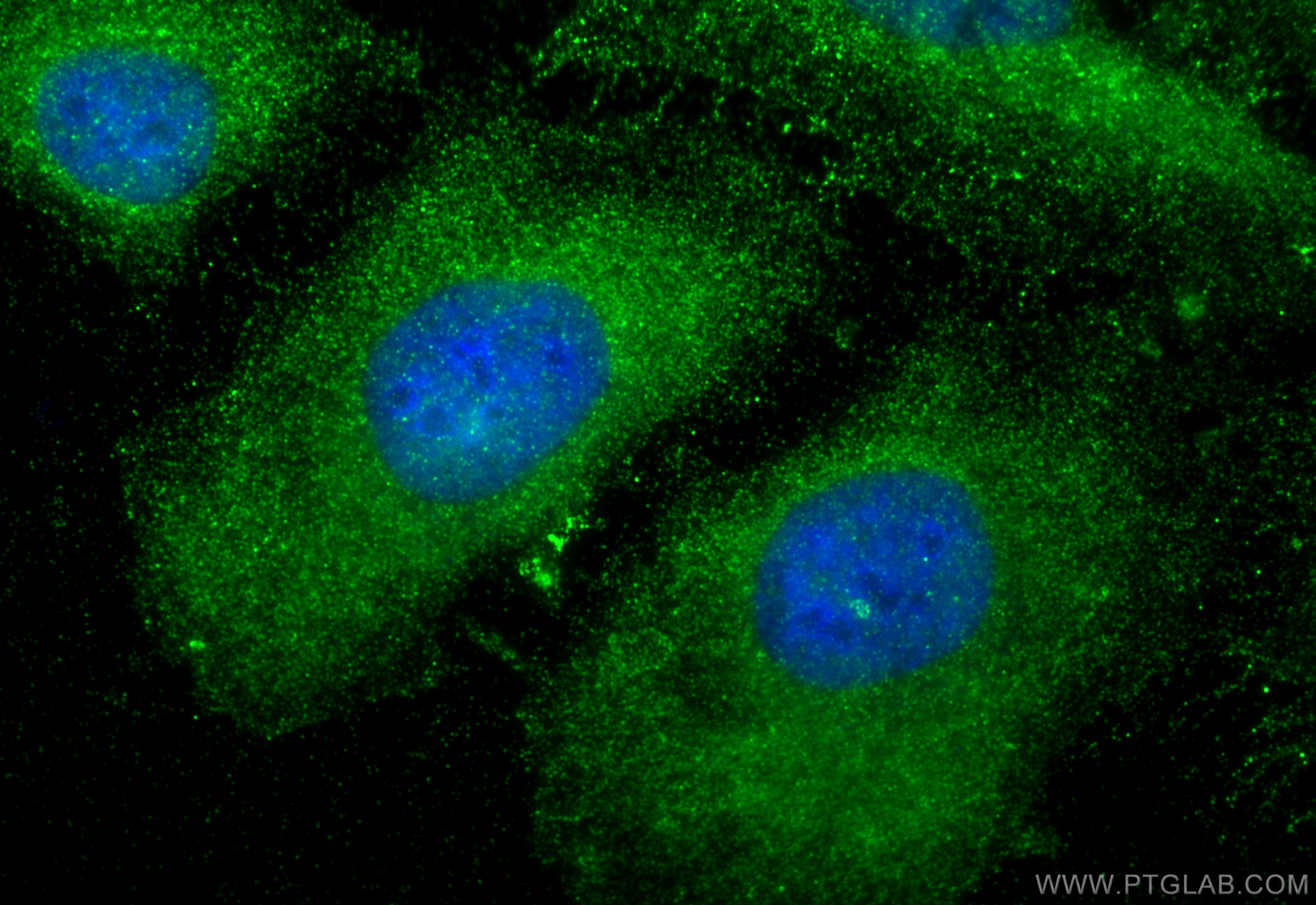 IF Staining of HeLa using 27248-1-AP