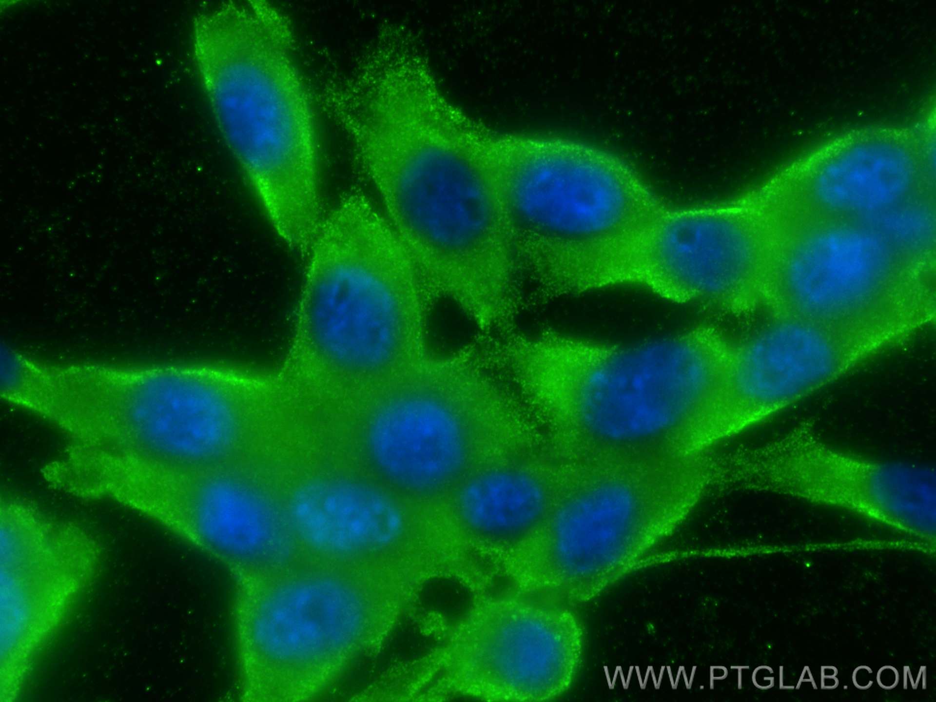 IF Staining of NIH/3T3 using 66867-2-Ig