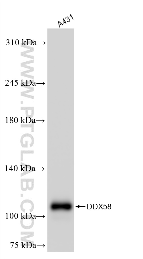 WB analysis of A431 using 84861-5-RR (same clone as 84861-5-PBS)