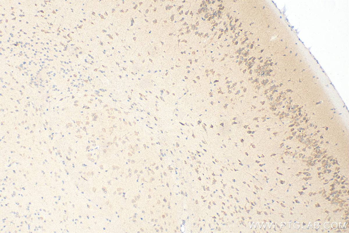 IHC staining of mouse brain using 13574-1-AP