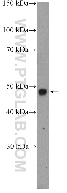 WB analysis of mouse eye using 26111-1-AP