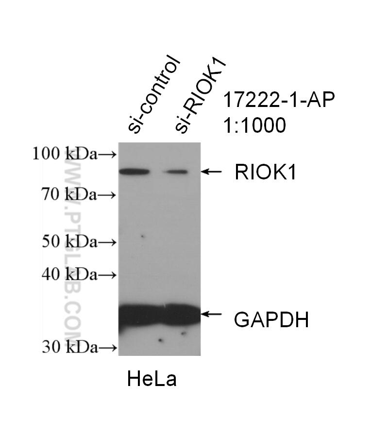 WB analysis of HeLa using 17222-1-AP