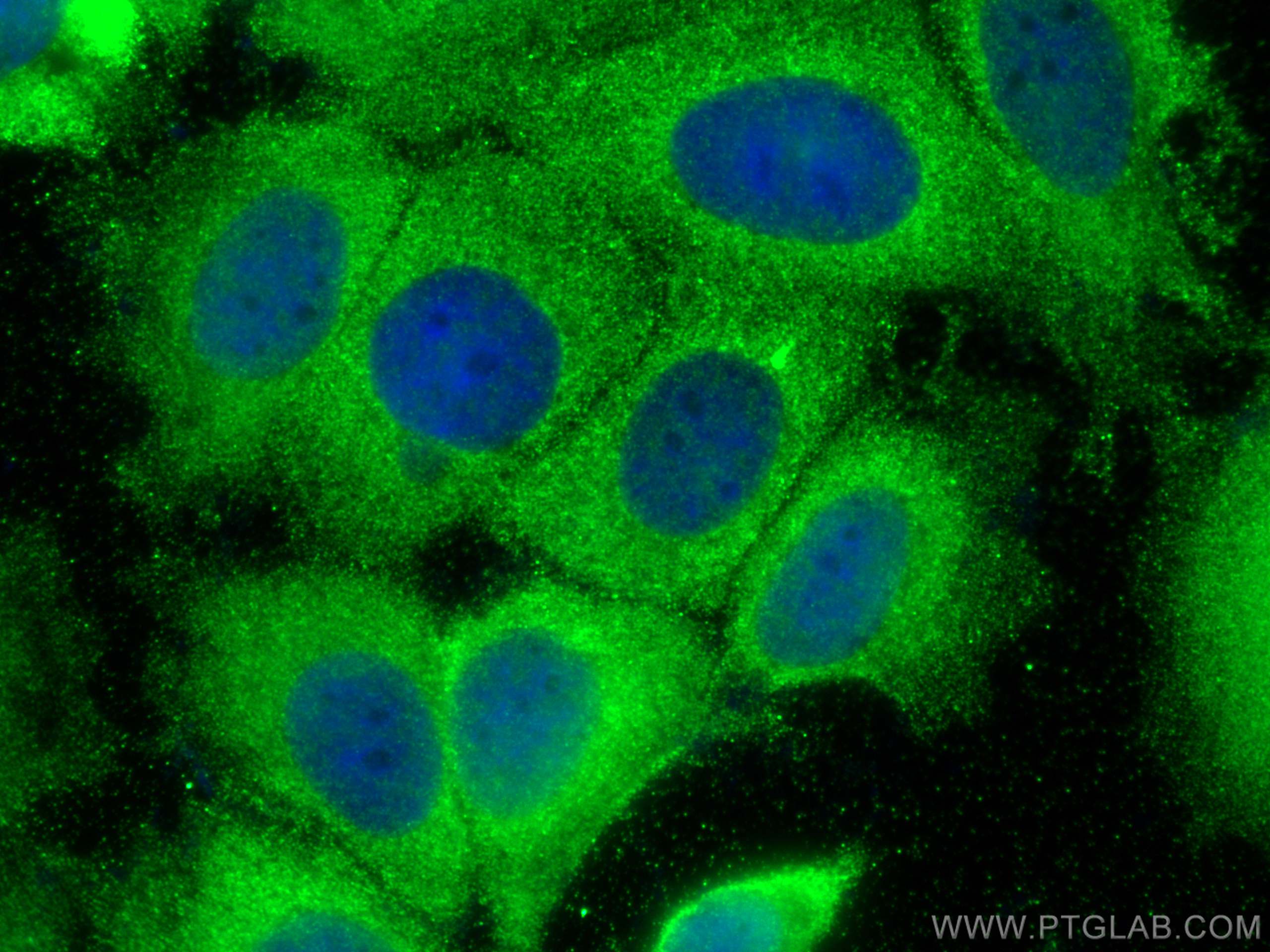 IF Staining of MCF-7 using 13593-1-AP