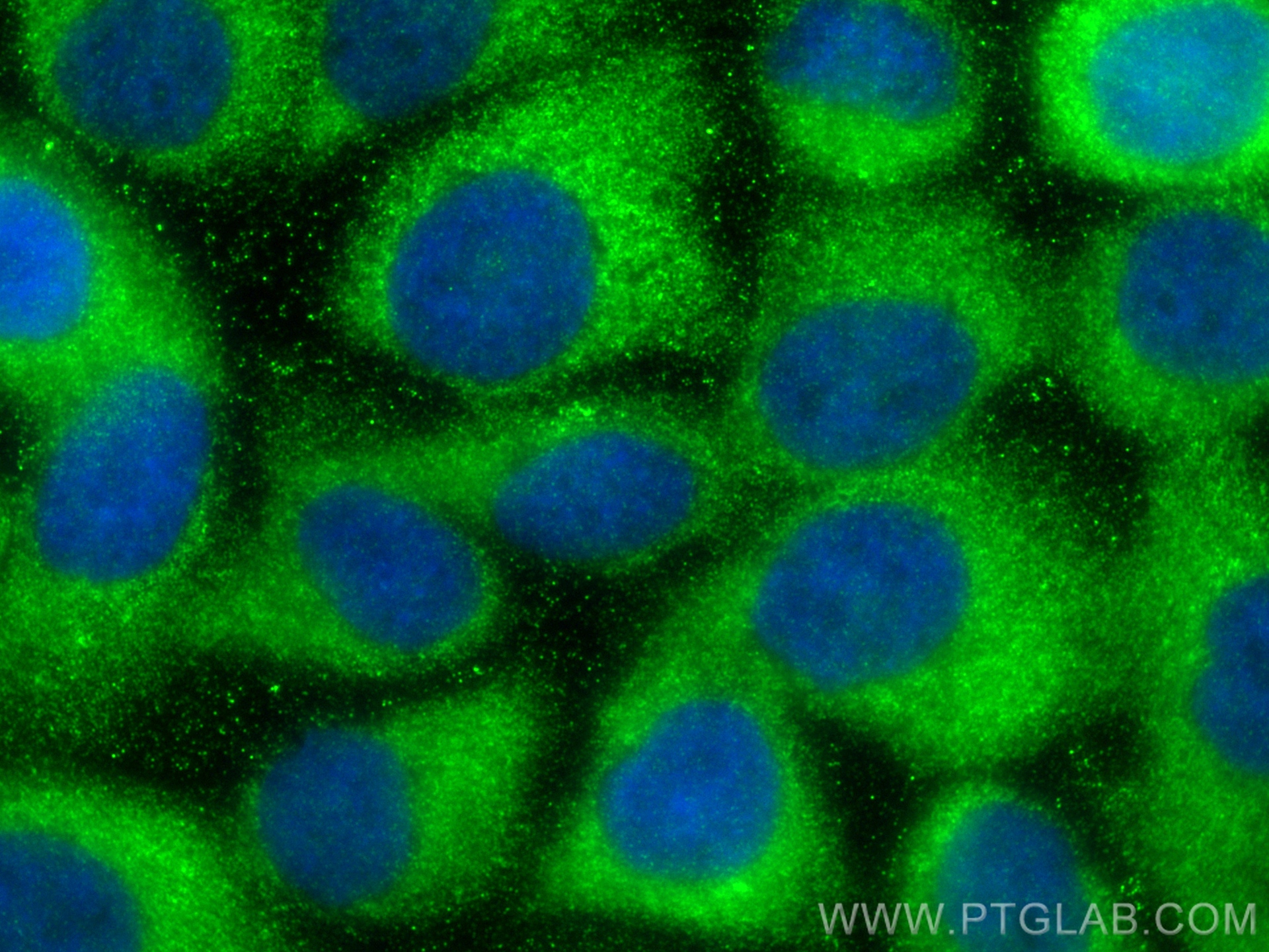 IF Staining of A431 using 13593-1-AP