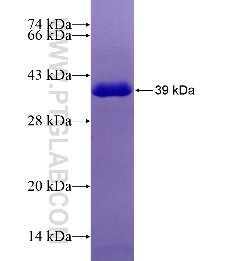 RIOK3 fusion protein Ag29019 SDS-PAGE