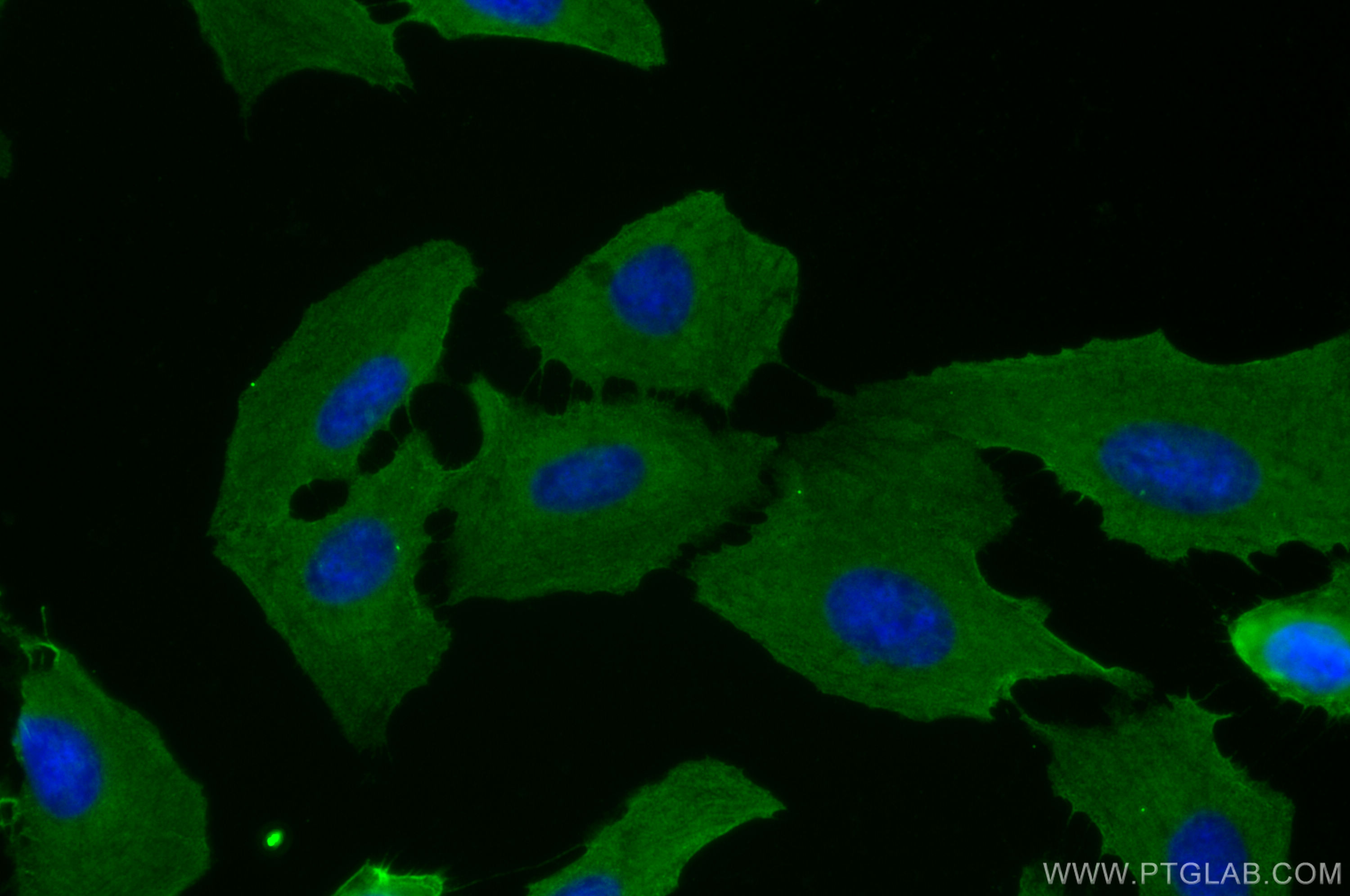 IF Staining of U2OS using 66854-1-Ig (same clone as 66854-1-PBS)