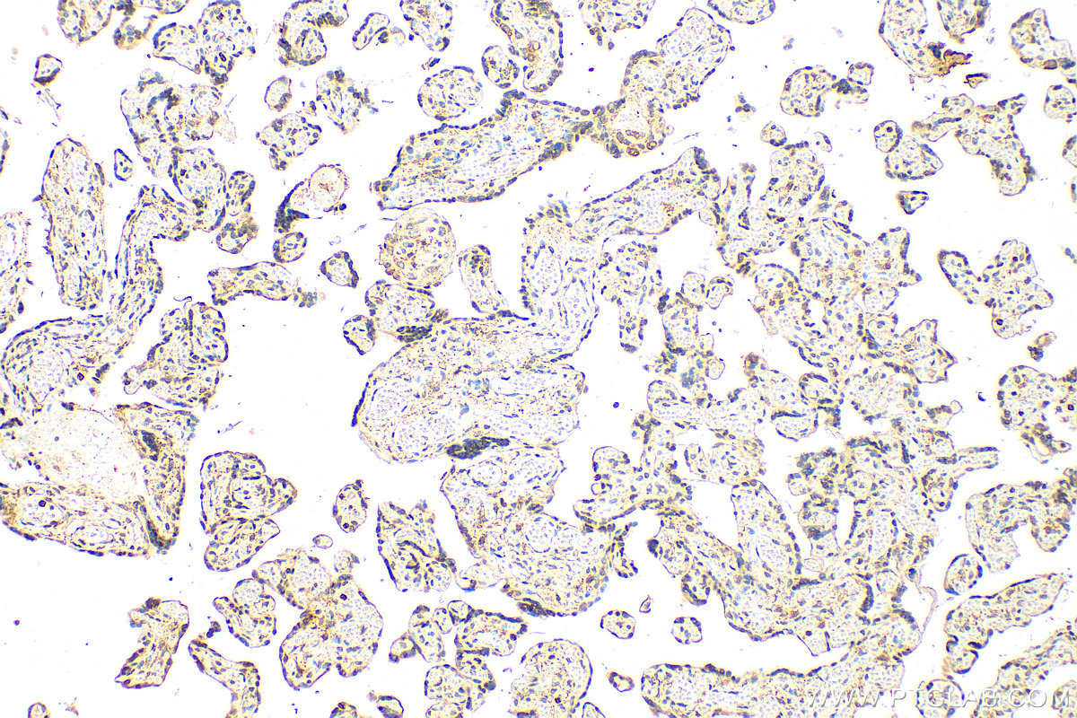 IHC staining of human placenta using 17563-1-AP (same clone as 17563-1-PBS)