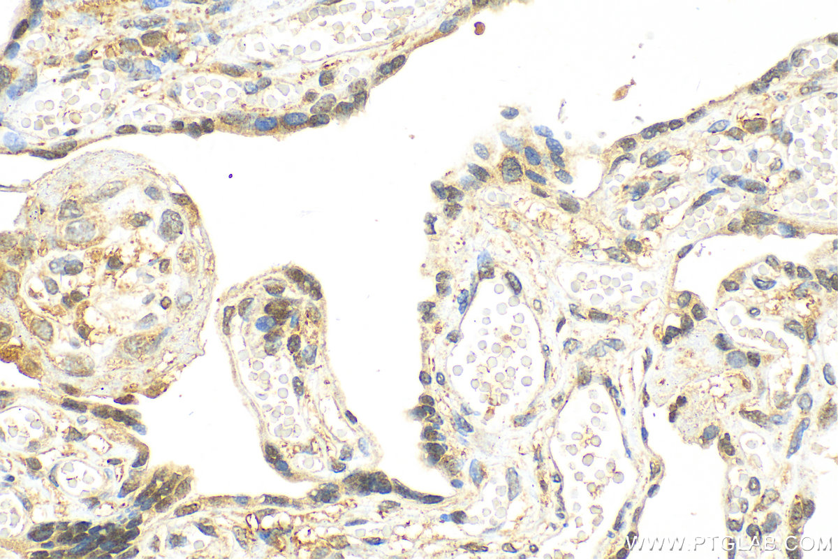 IHC staining of human placenta using 17563-1-AP (same clone as 17563-1-PBS)