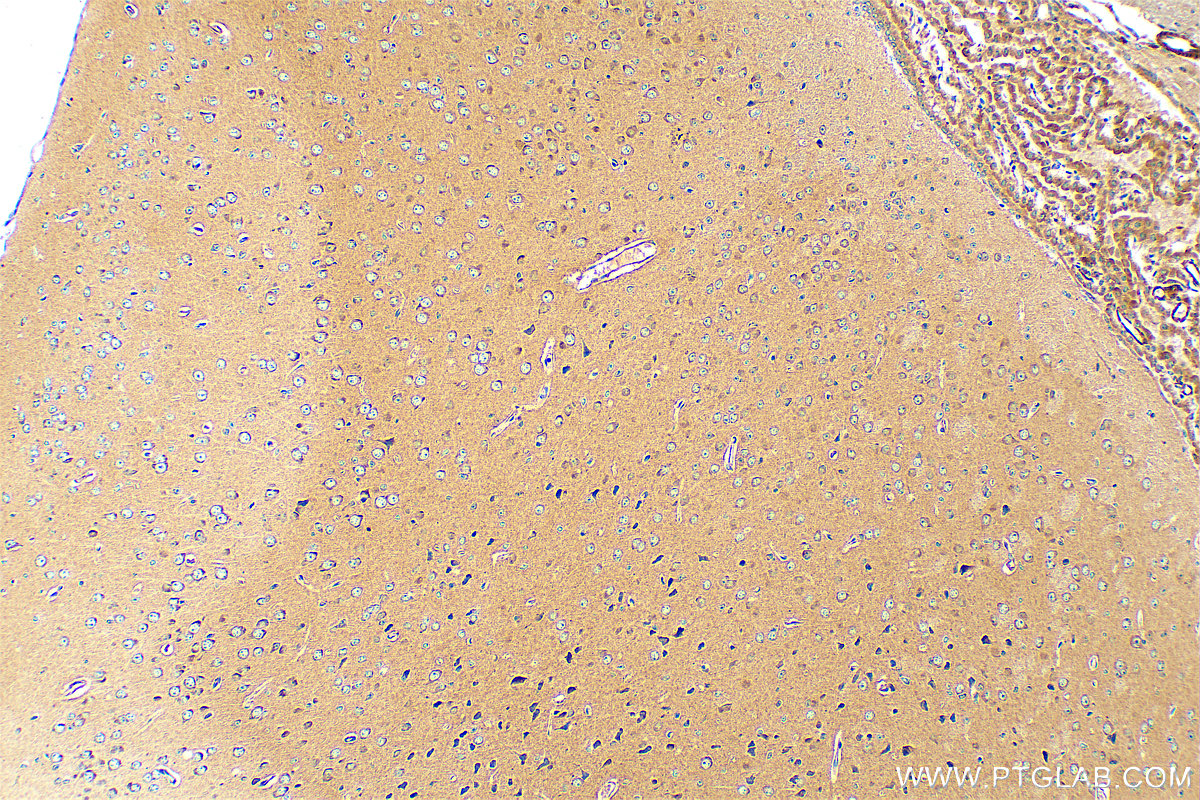 IHC staining of mouse brain using 12473-1-AP