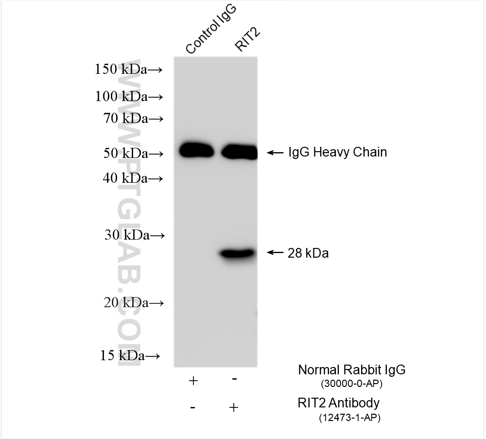 IP experiment of mouse brain using 12473-1-AP