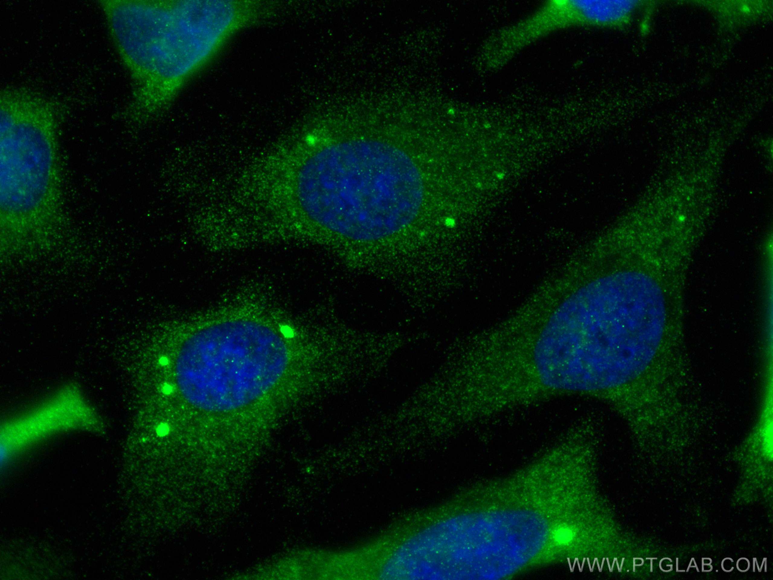 IF Staining of HeLa using 15356-1-AP