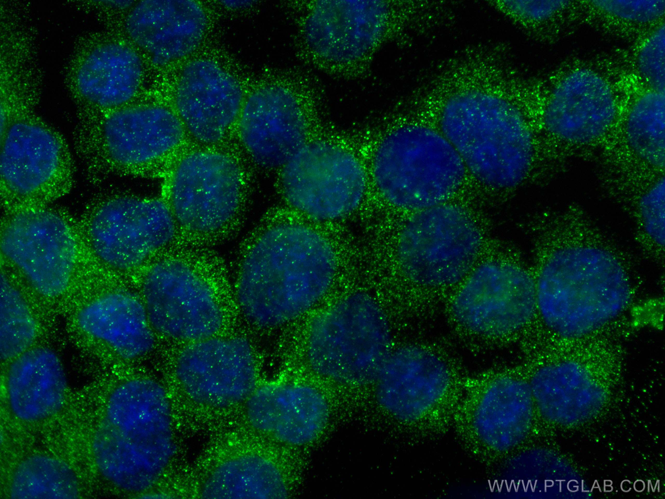 IF Staining of Y79 using 15356-1-AP