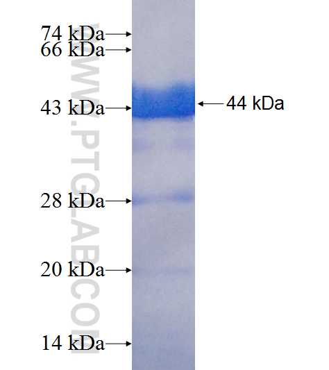 RLIM fusion protein Ag9090 SDS-PAGE