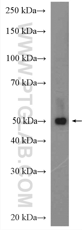 WB analysis of human plasma using 17559-1-AP