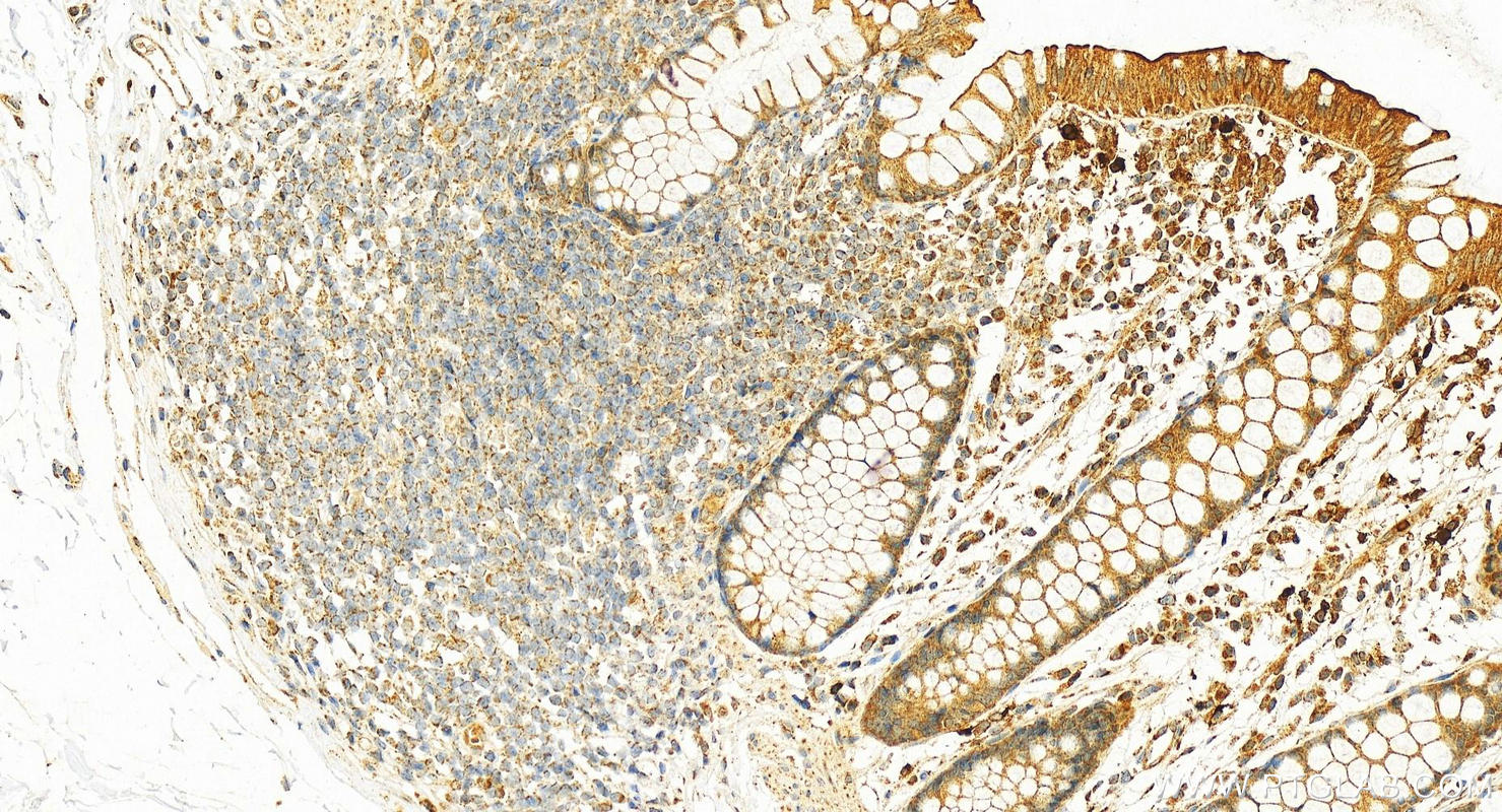 IHC staining of human colon using 18172-1-AP