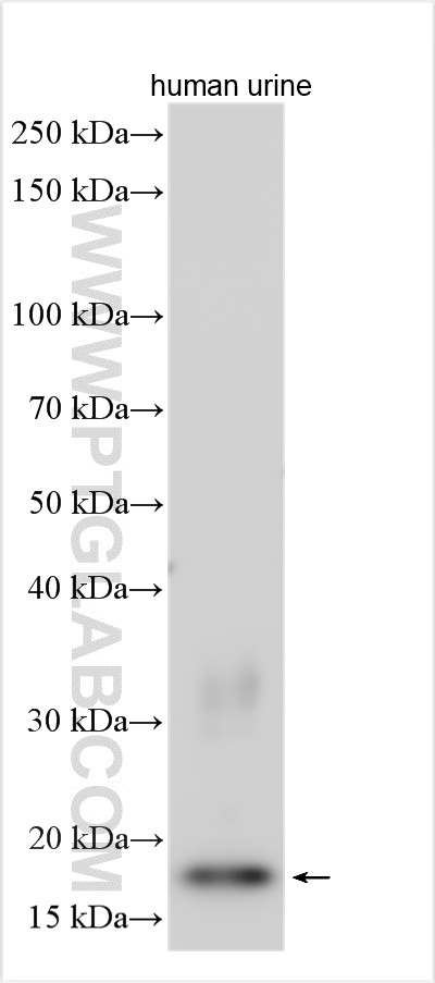 WB analysis using 18172-1-AP (same clone as 18172-1-PBS)