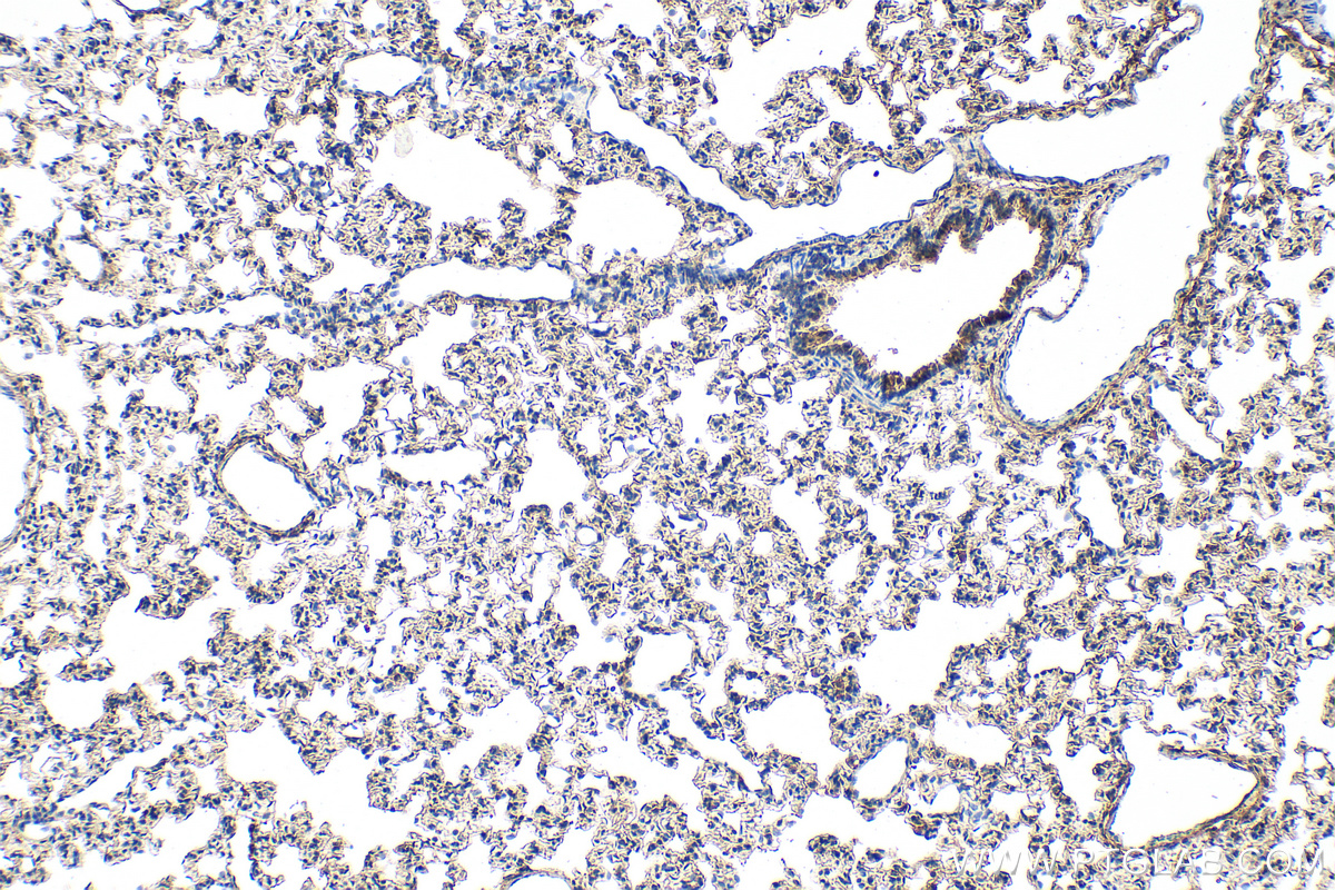 IHC staining of rat lung using 30732-1-AP (same clone as 30732-1-PBS)