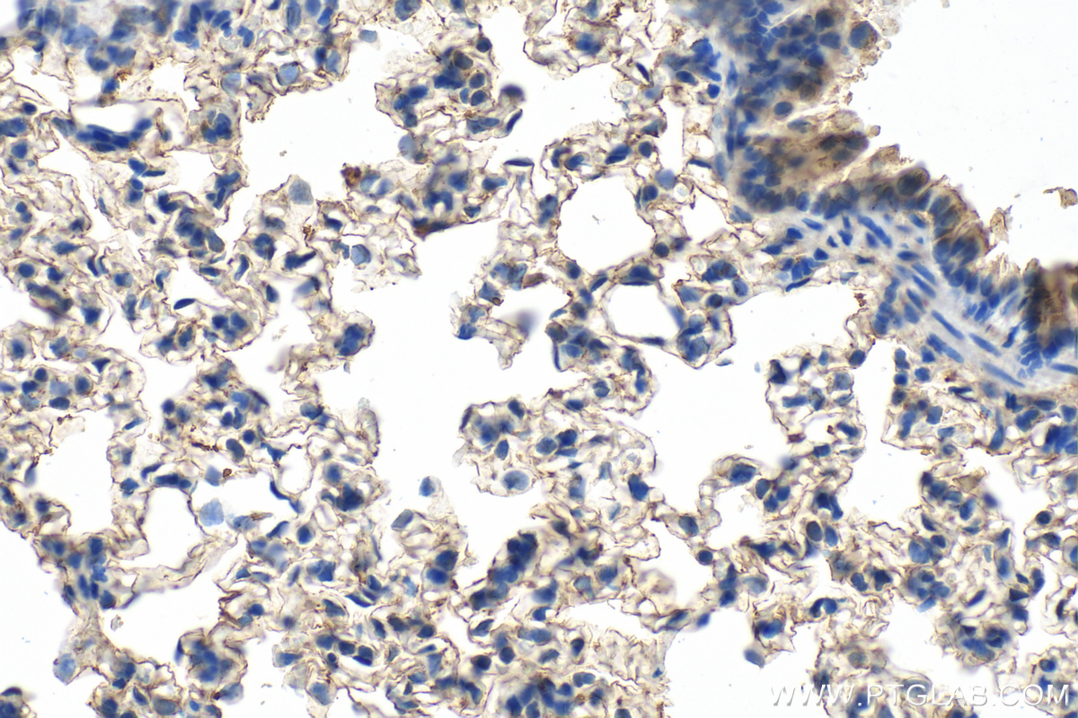 IHC staining of rat lung using 30732-1-AP (same clone as 30732-1-PBS)