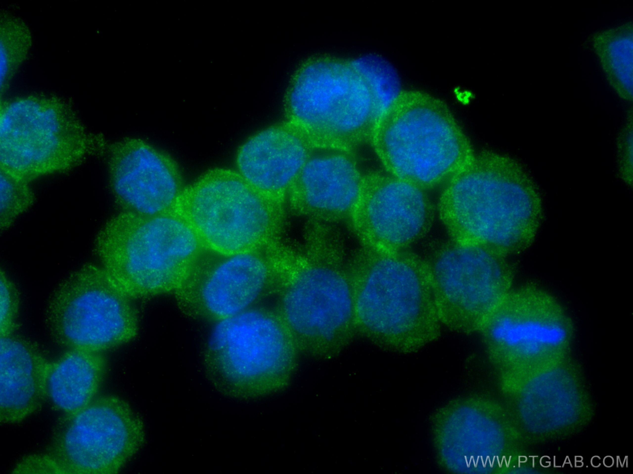 IF Staining of THP-1 using 16425-1-AP