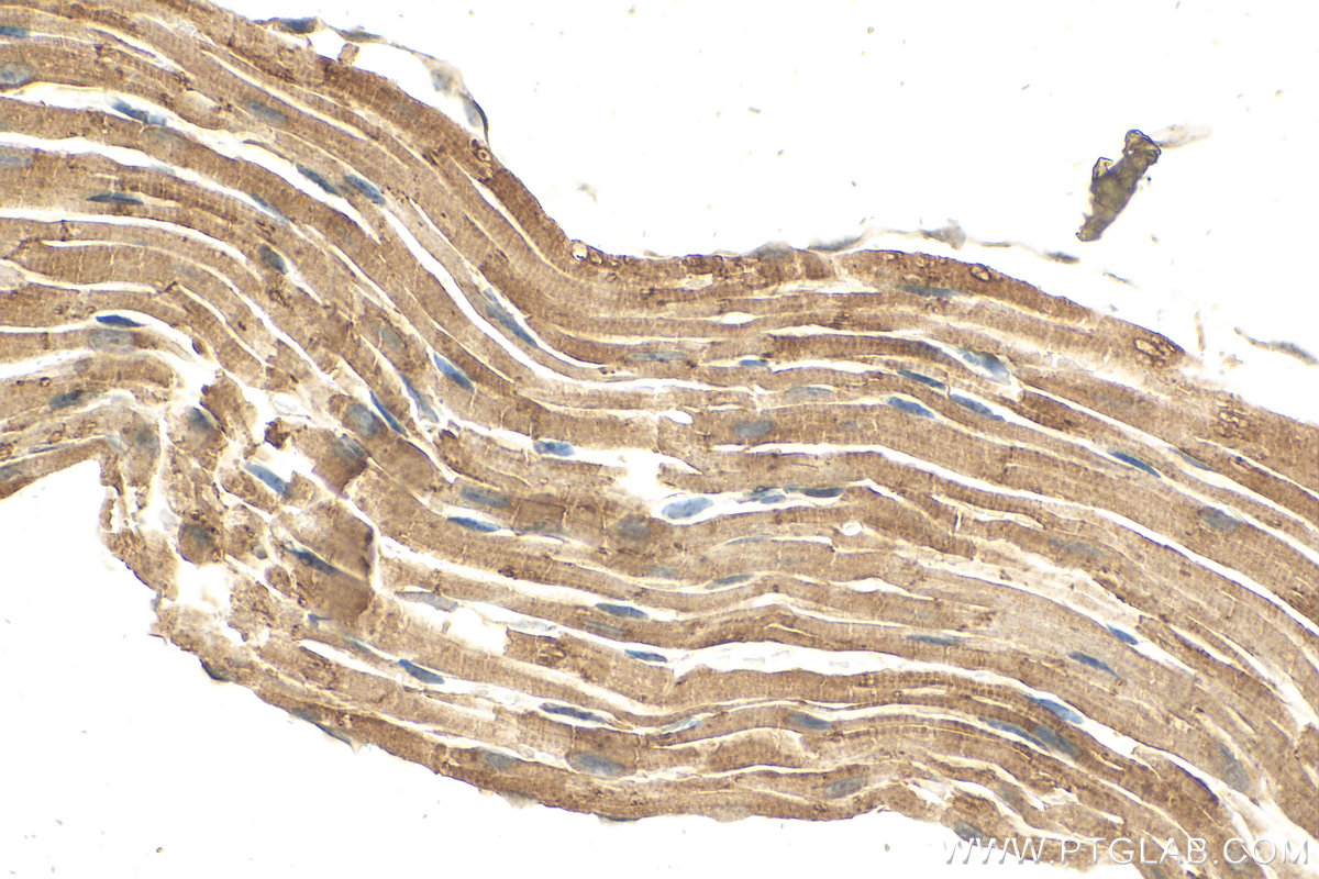 IHC staining of mouse heart using 16425-1-AP