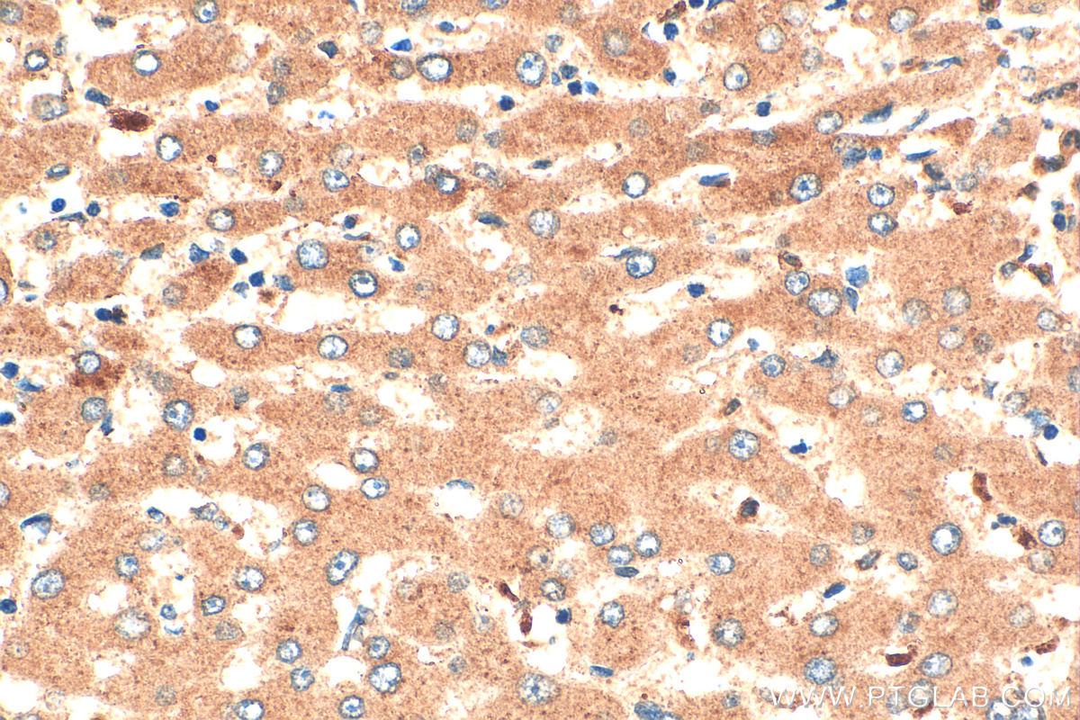 IHC staining of human liver using 16425-1-AP