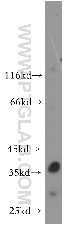 WB analysis of mouse thymus using 17527-1-AP