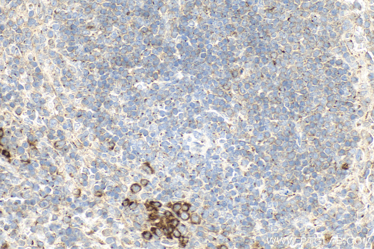 IHC staining of mouse spleen using 13753-1-AP