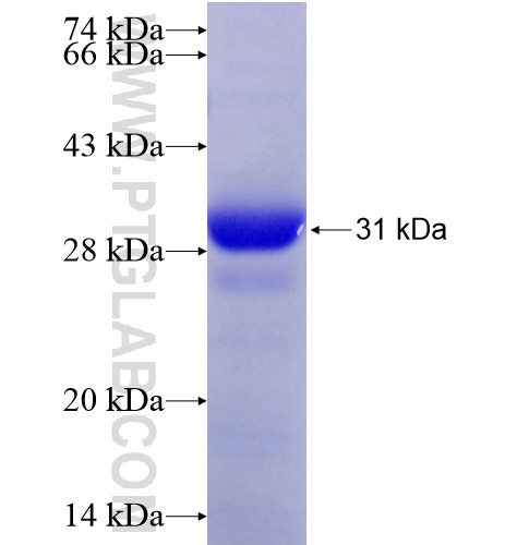 RNASET2 fusion protein Ag28353 SDS-PAGE