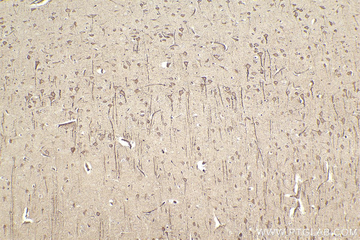 IHC staining of rat brain using 13844-1-AP