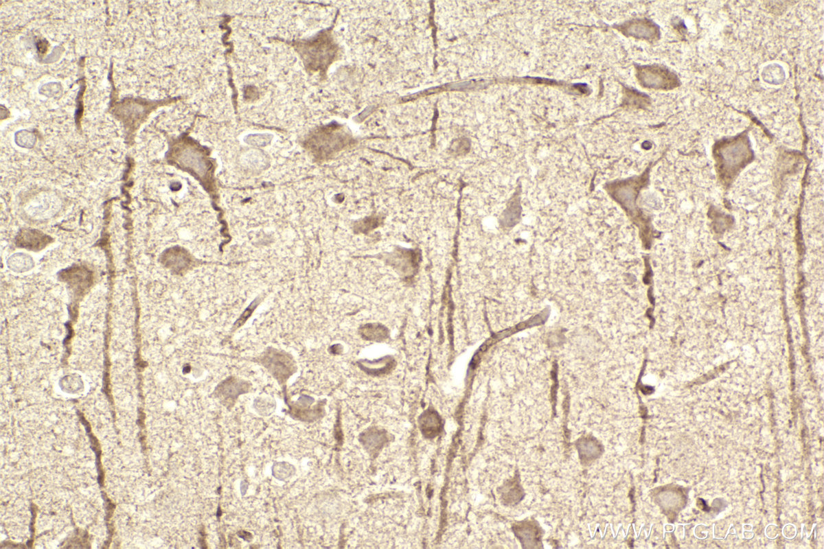 IHC staining of rat brain using 13844-1-AP