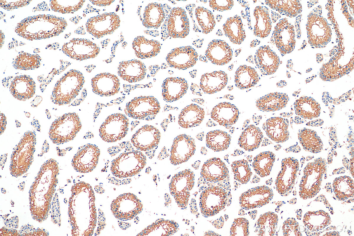 IHC staining of mouse testis using 20792-1-AP