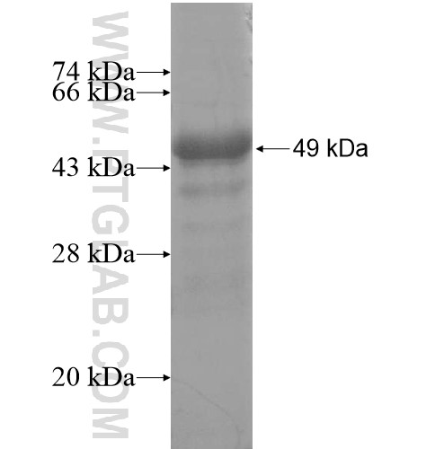 RNF133 fusion protein Ag14537 SDS-PAGE